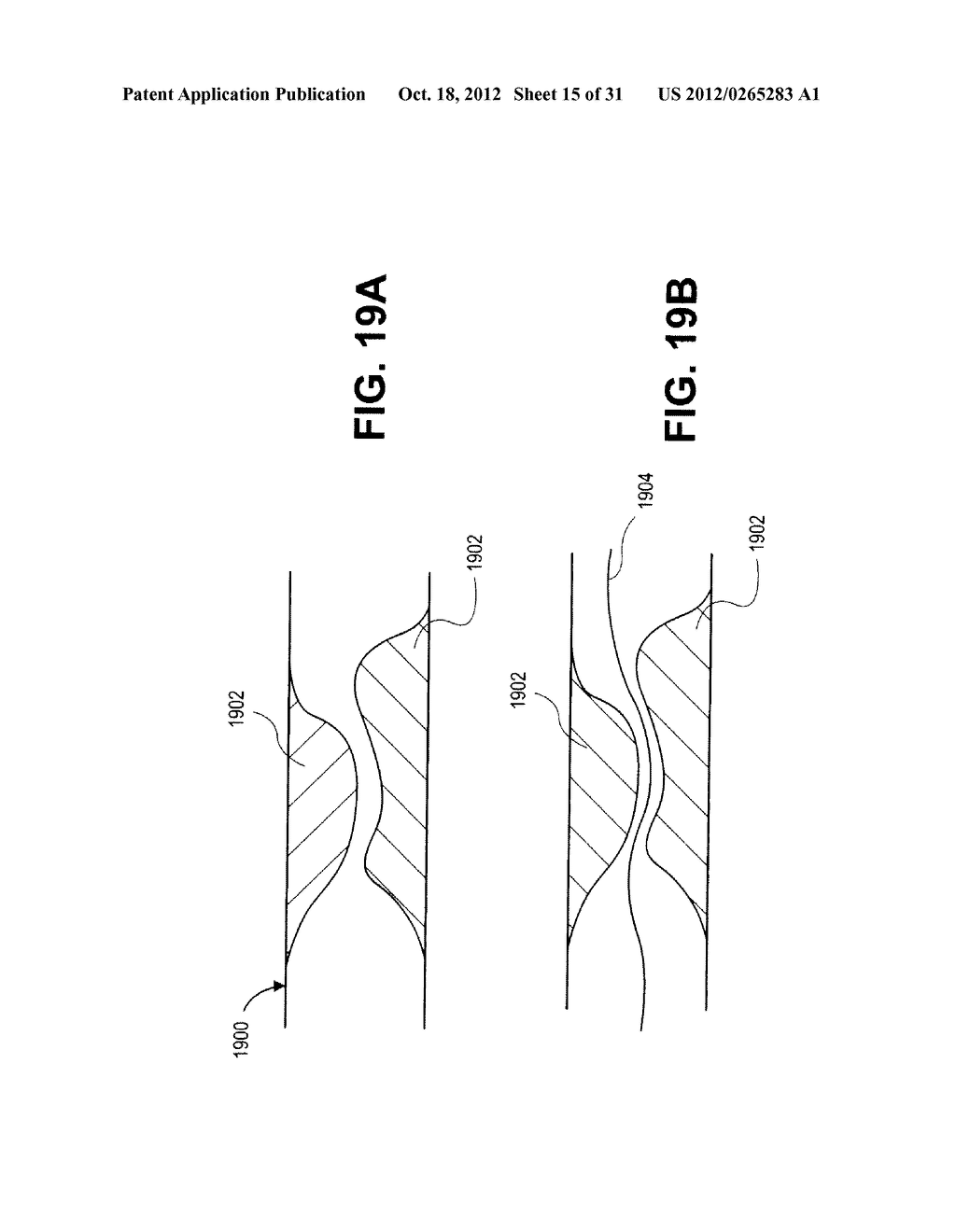 REPERFUSION INJURY DEVICES - diagram, schematic, and image 16