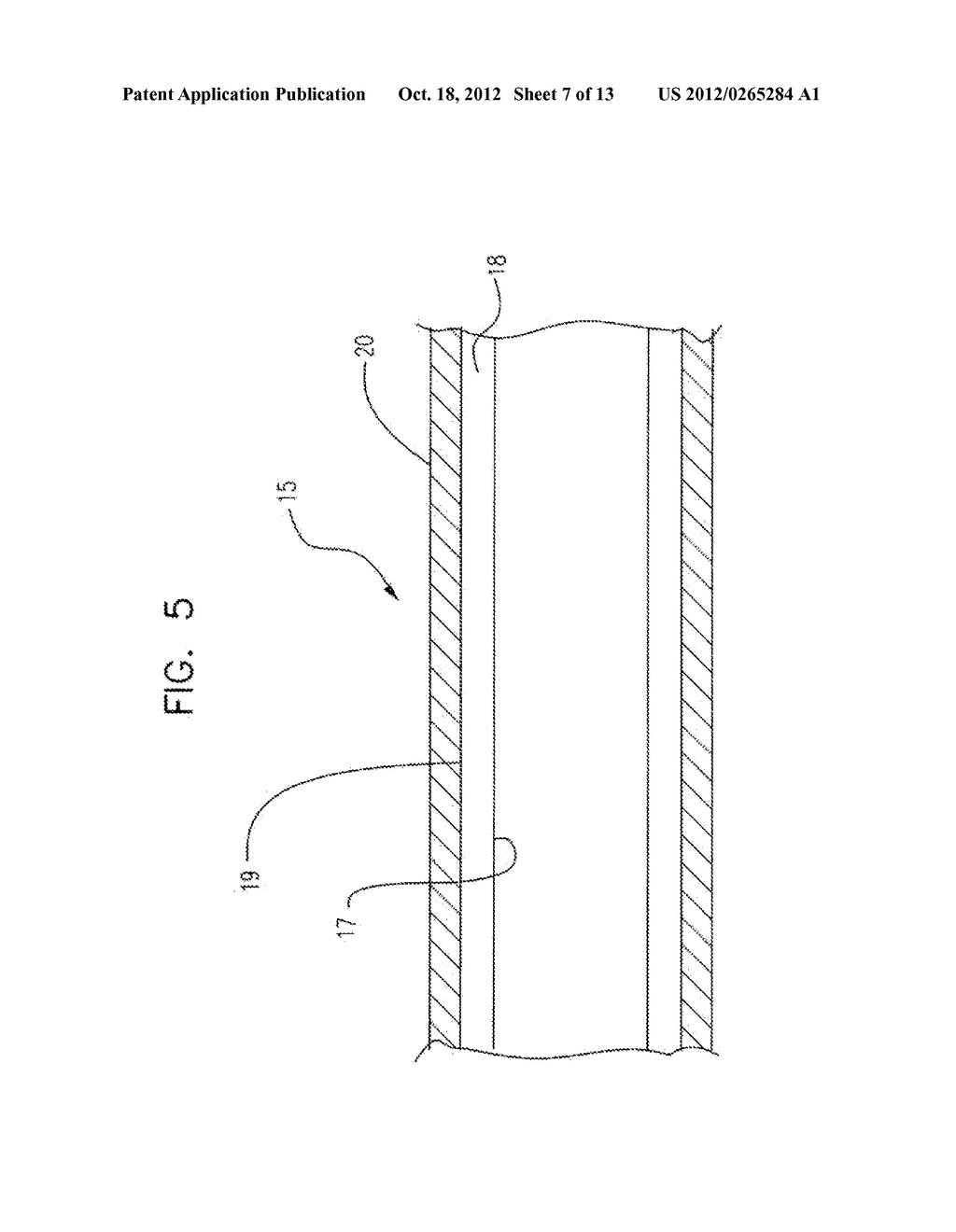 MULTILAYER BALLOON FOR BIFURCATED STENT DELIVERY AND METHODS OF MAKING AND     USING THE SAME - diagram, schematic, and image 08