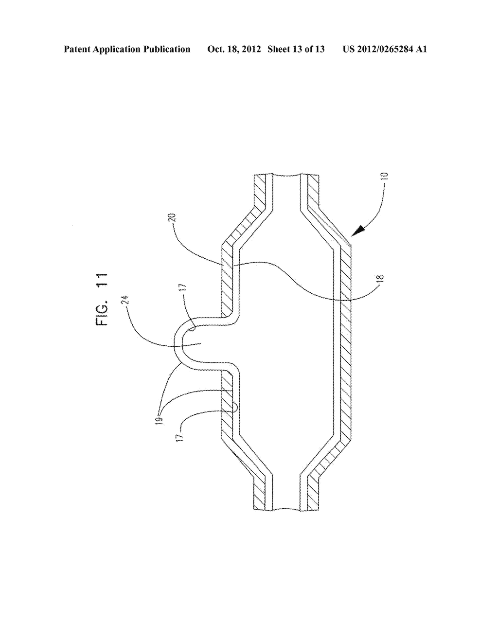 MULTILAYER BALLOON FOR BIFURCATED STENT DELIVERY AND METHODS OF MAKING AND     USING THE SAME - diagram, schematic, and image 14