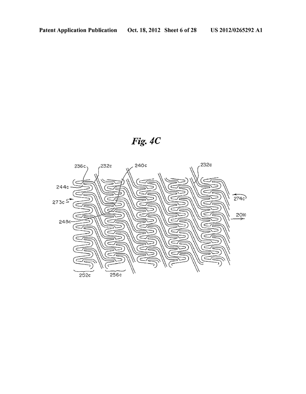 STENT - diagram, schematic, and image 07