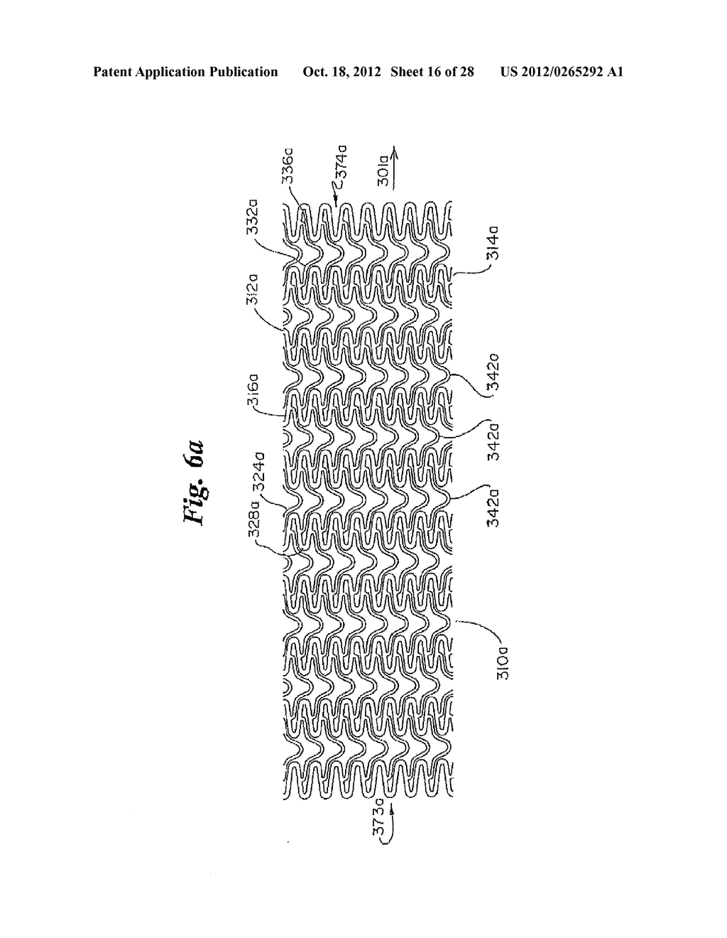 STENT - diagram, schematic, and image 17