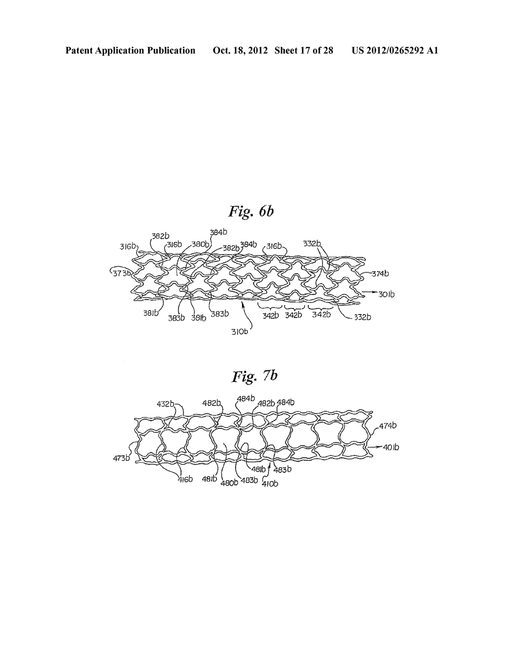 STENT - diagram, schematic, and image 18