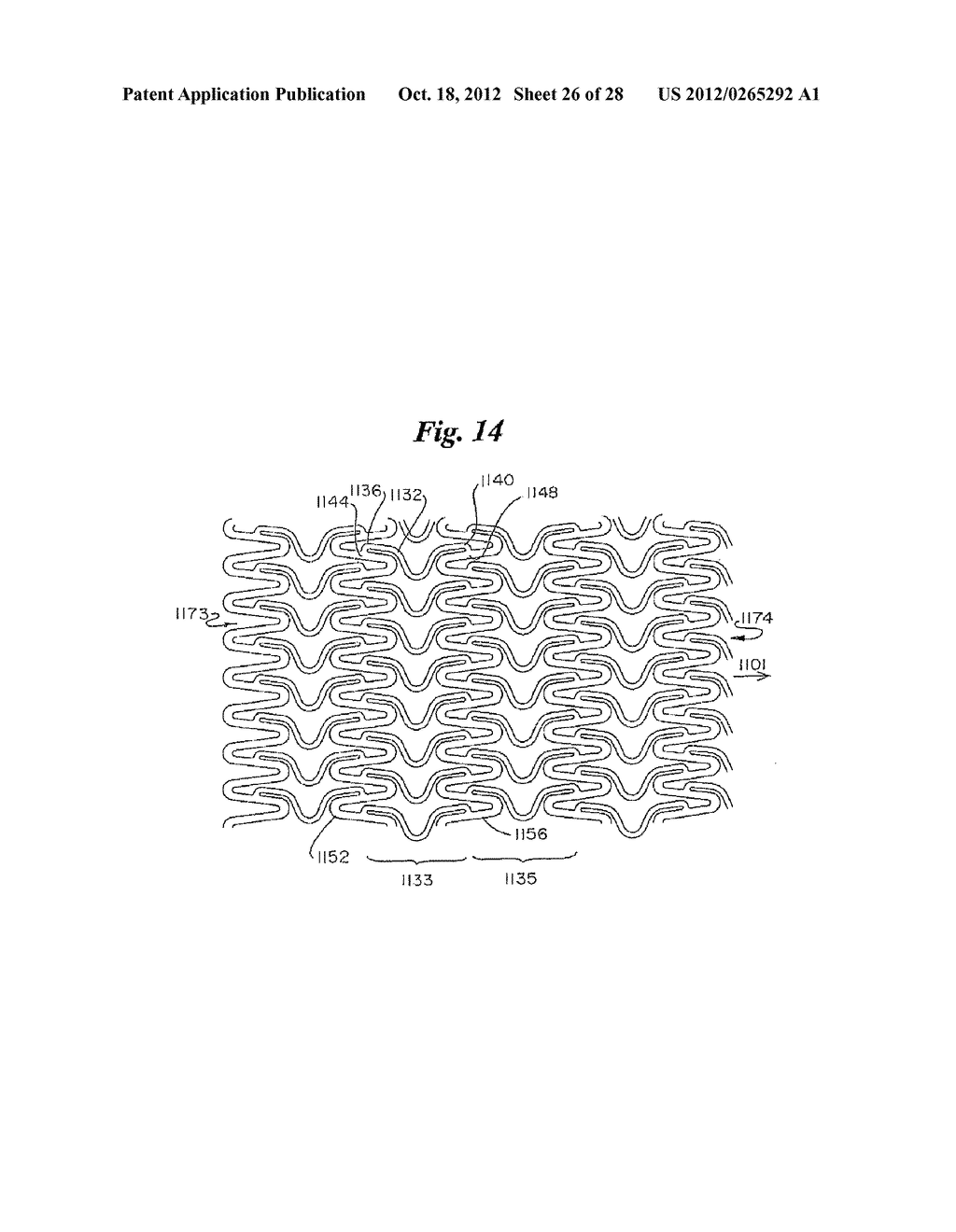 STENT - diagram, schematic, and image 27