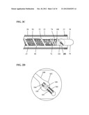 STENT SYSTEM HAVING INTERMESHING SIDE EXTENSION MEMBERS diagram and image