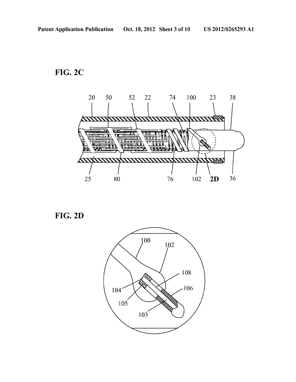 STENT SYSTEM HAVING INTERMESHING SIDE EXTENSION MEMBERS - diagram, schematic, and image 04