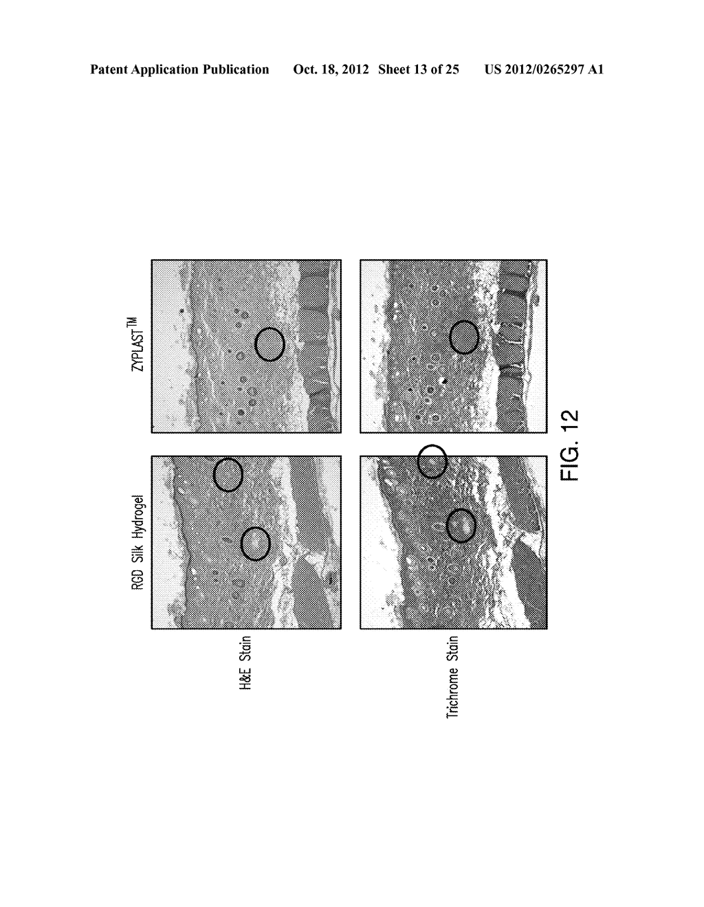 SILK FIBROIN HYDROGELS AND USES THEREOF - diagram, schematic, and image 14