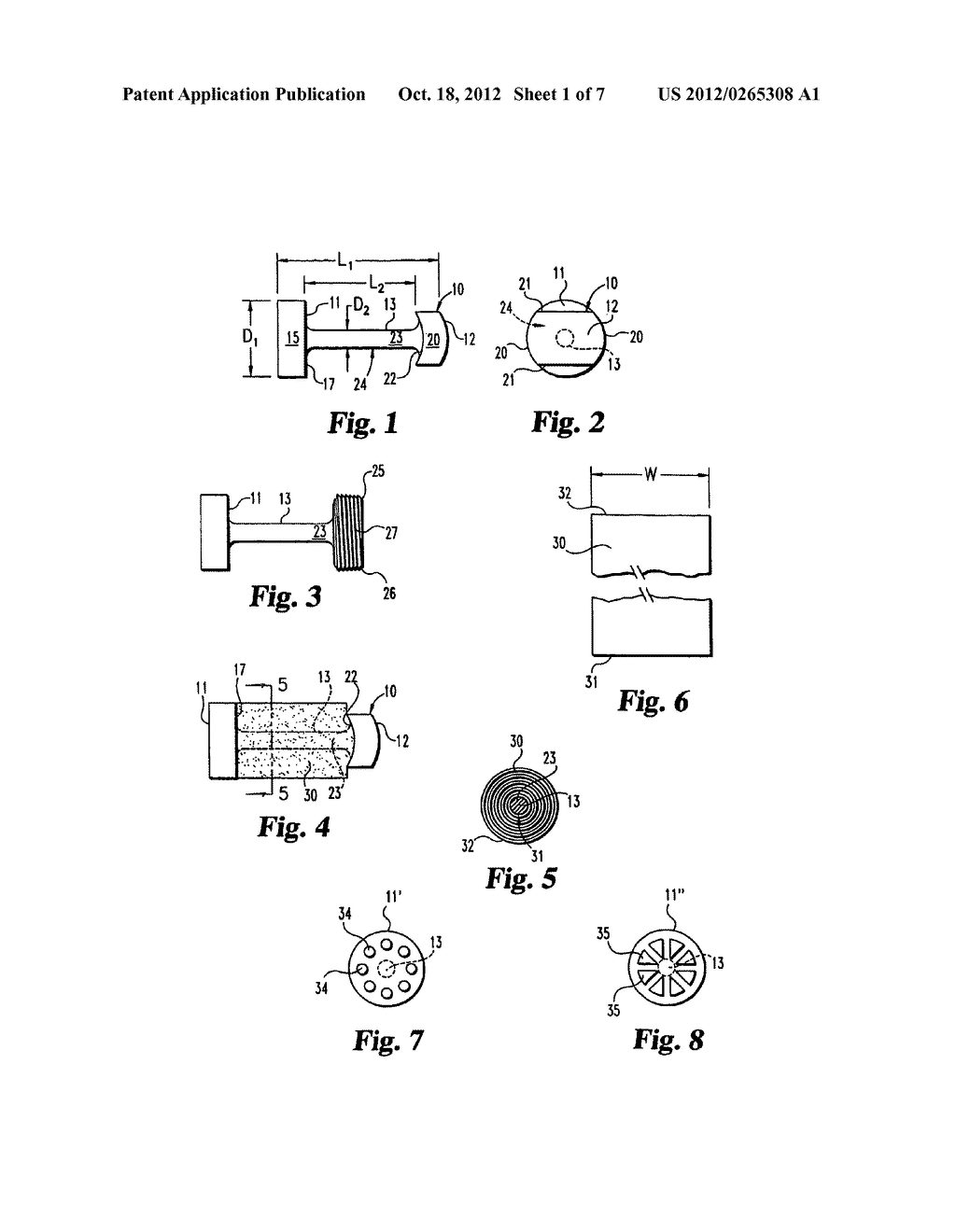 OSTEOGENIC FUSION DEVICE - diagram, schematic, and image 02