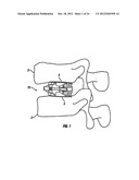 Expandable Fusion Device and Method of Installation Thereof diagram and image