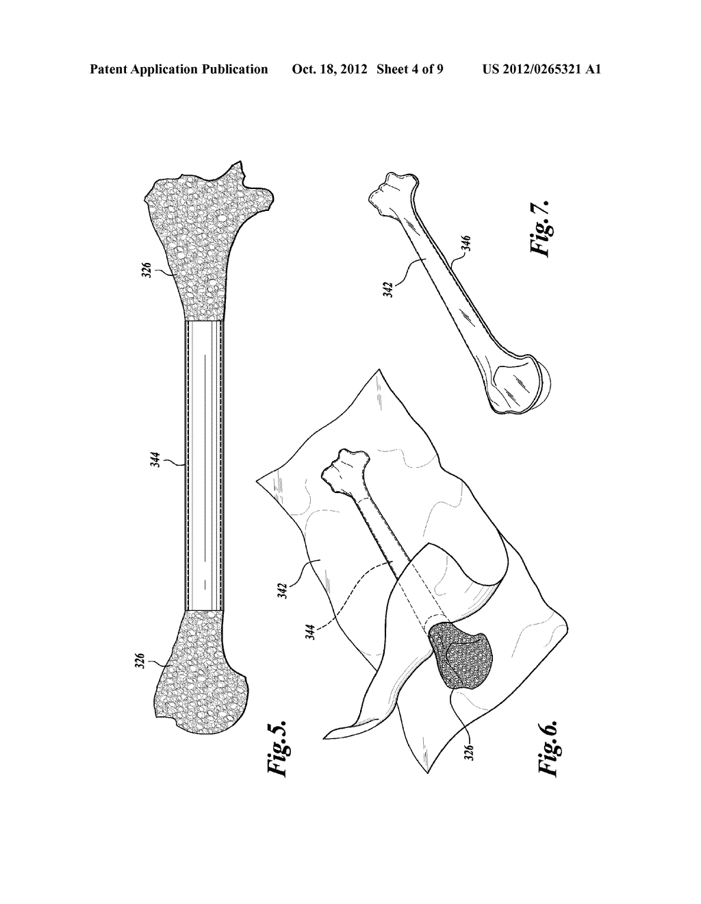 ARTIFICIAL BONES AND METHODS OF MAKING SAME - diagram, schematic, and image 05