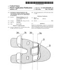 METHODS OF PREDETERMINING THE CONTOUR OF A RESECTED BONE SURFACE AND     ASSESSING THE FIT OF A PROSTHESIS ON THE BONE diagram and image