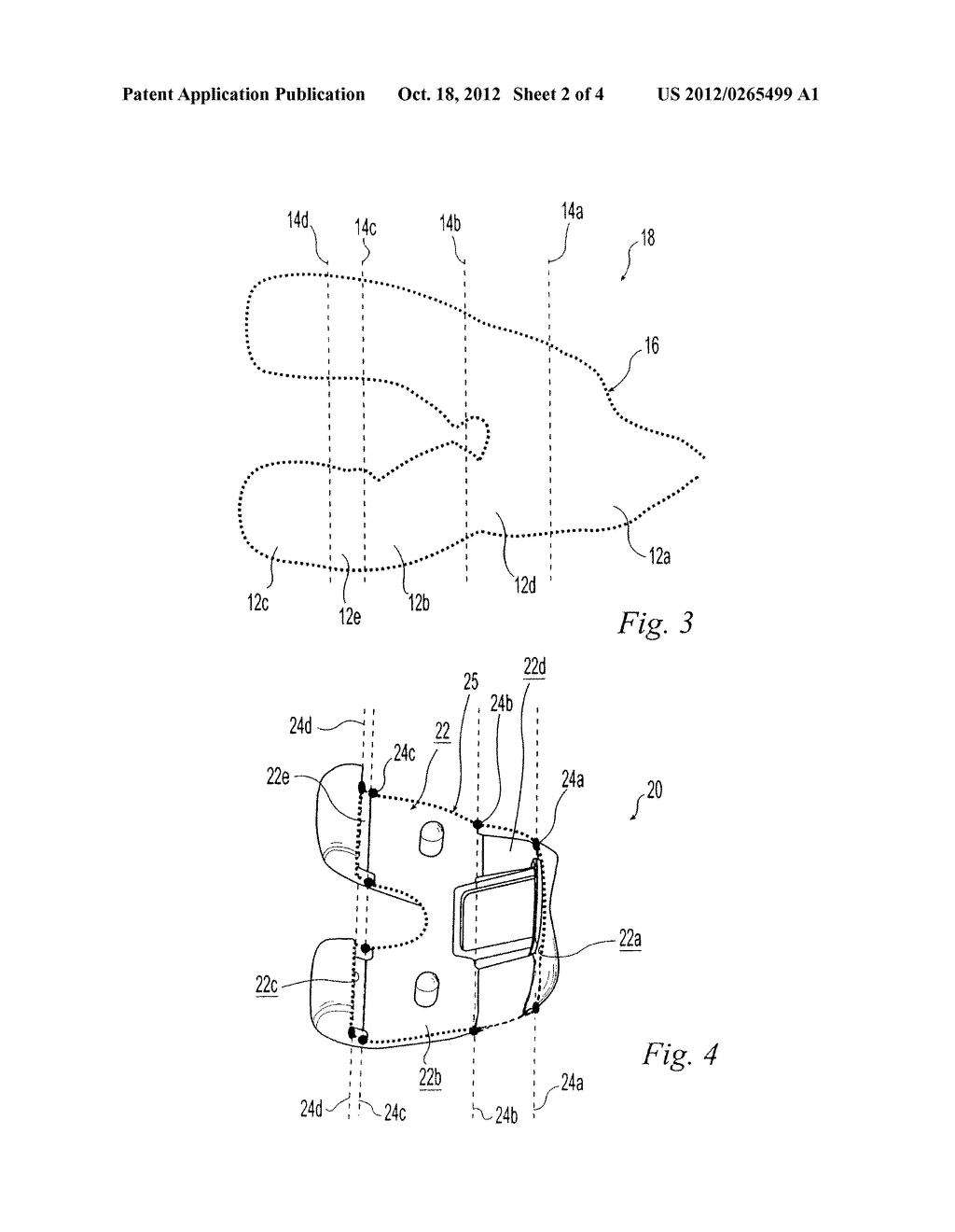 METHODS OF PREDETERMINING THE CONTOUR OF A RESECTED BONE SURFACE AND     ASSESSING THE FIT OF A PROSTHESIS ON THE BONE - diagram, schematic, and image 03