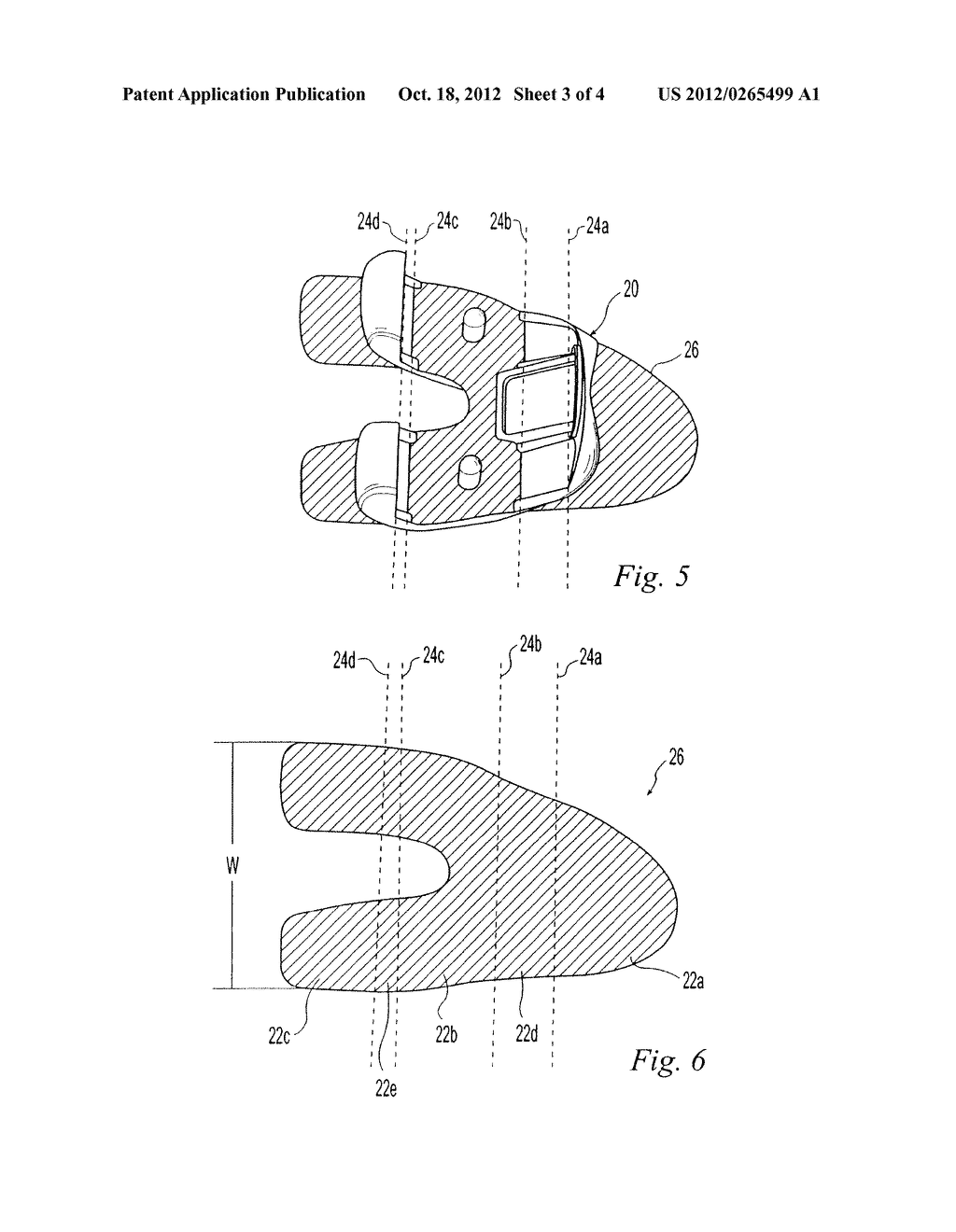 METHODS OF PREDETERMINING THE CONTOUR OF A RESECTED BONE SURFACE AND     ASSESSING THE FIT OF A PROSTHESIS ON THE BONE - diagram, schematic, and image 04