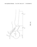 Medical Support Pillow for Facilitating Tracheal Intubation on Obese     Patient diagram and image