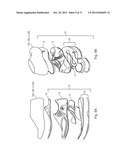 Support System for Footwear Providing Support at or Below the     Sustentaculum Tali diagram and image