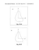 Support System for Footwear Providing Support at or Below the     Sustentaculum Tali diagram and image