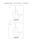 Support System for Footwear Providing Support at or Below the     Sustentaculum Tali diagram and image