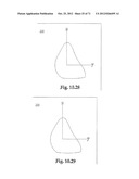 Support System for Footwear Providing Support at or Below the     Sustentaculum Tali diagram and image