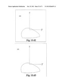 Support System for Footwear Providing Support at or Below the     Sustentaculum Tali diagram and image