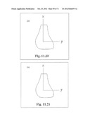 Support System for Footwear Providing Support at or Below the     Sustentaculum Tali diagram and image