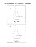 Support System for Footwear Providing Support at or Below the     Sustentaculum Tali diagram and image