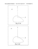 Support System for Footwear Providing Support at or Below the     Sustentaculum Tali diagram and image