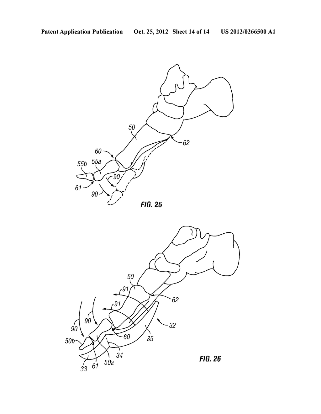 Eccentric Toe-Off Cam Lever - diagram, schematic, and image 15
