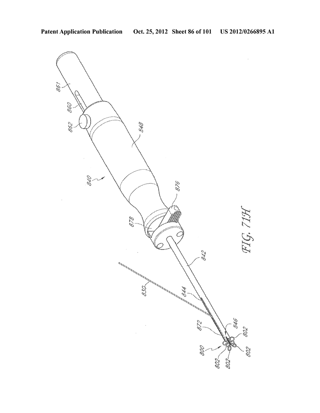 SYSTEM AND METHOD FOR PERCUTANEOUS PALATE REMODELING - diagram, schematic, and image 87