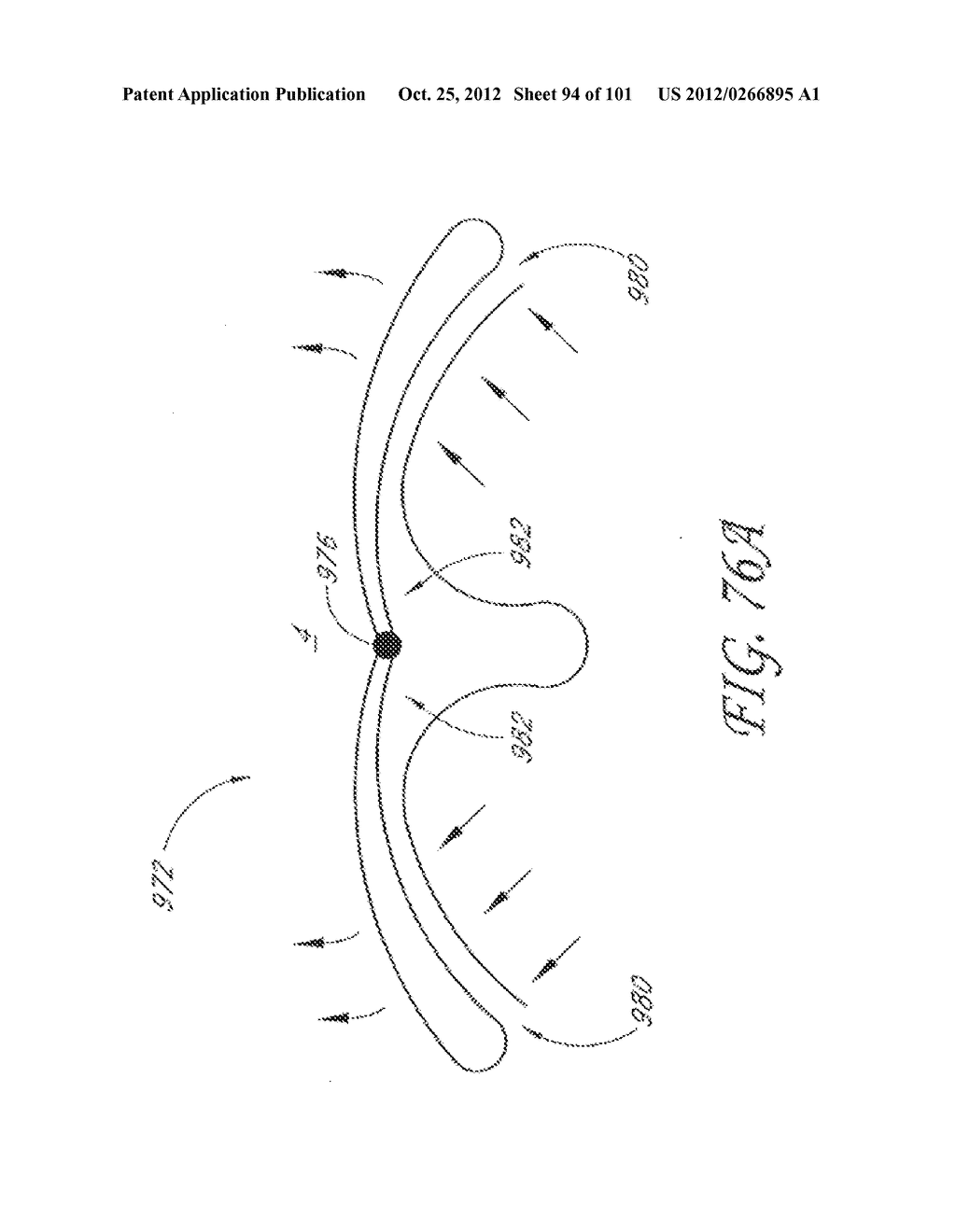 SYSTEM AND METHOD FOR PERCUTANEOUS PALATE REMODELING - diagram, schematic, and image 95