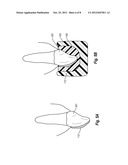 METHODS AND APPARATUS FOR THE RAPID MANUFACTURE OF DIRECT CUSTOM     MOUTHPIECES diagram and image