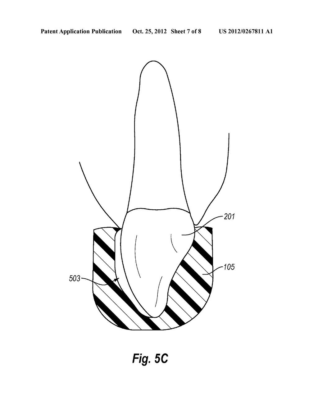 METHODS AND APPARATUS FOR THE RAPID MANUFACTURE OF DIRECT CUSTOM     MOUTHPIECES - diagram, schematic, and image 08