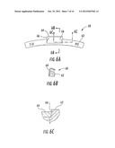 VEHICLE WHEEL BALANCE WEIGHTS diagram and image