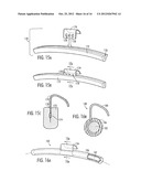 VEHICLE WHEEL BALANCE WEIGHTS diagram and image