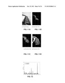 ON-SITE COMPOSITION AND AESTHETICS FEEDBACK THROUGH EXEMPLARS FOR     PHOTOGRAPHERS diagram and image