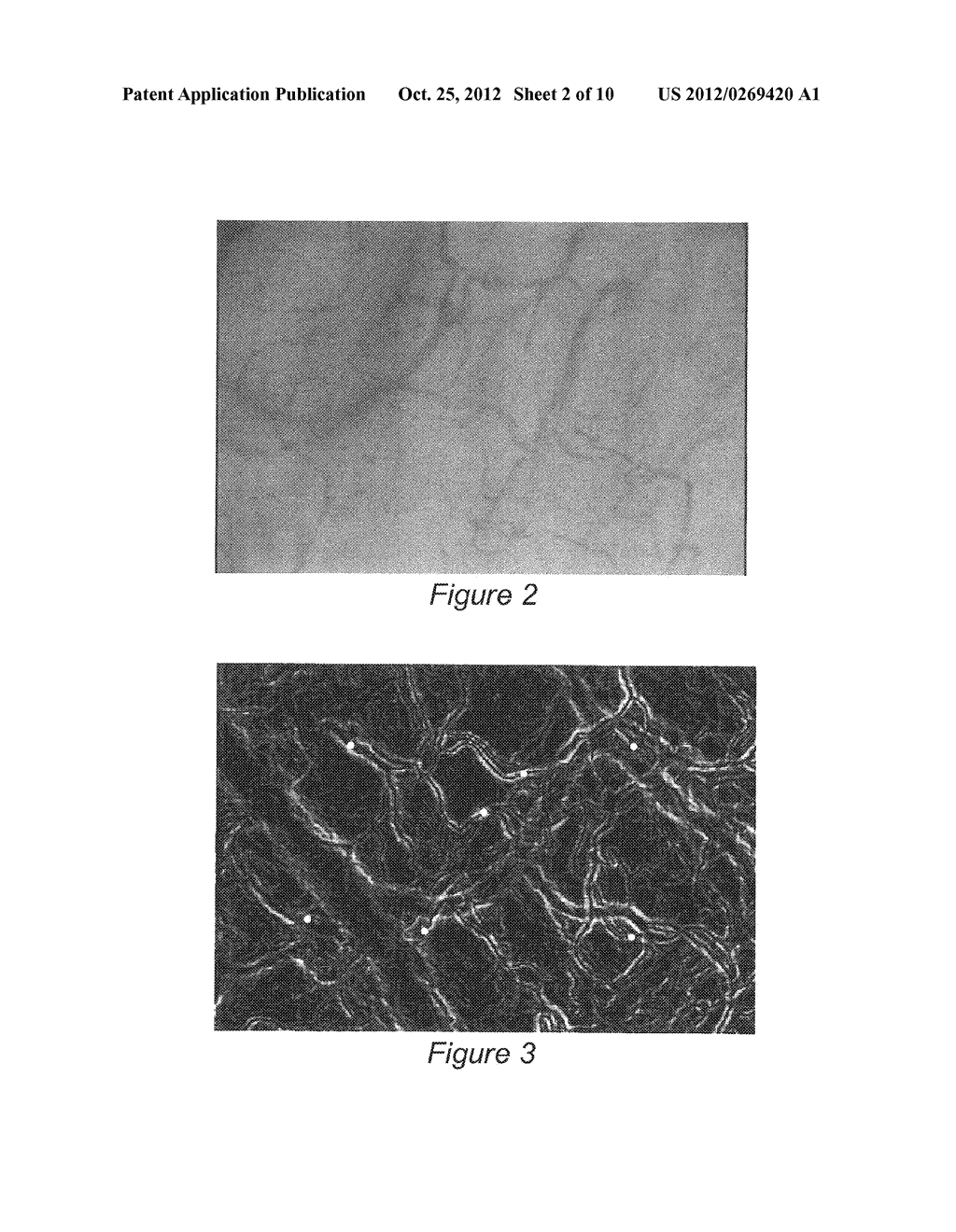 Image Processing and Machine Learning for Diagnostic Analysis of     Microcirculation - diagram, schematic, and image 03