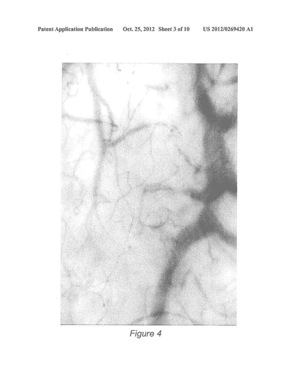 Image Processing and Machine Learning for Diagnostic Analysis of     Microcirculation - diagram, schematic, and image 04