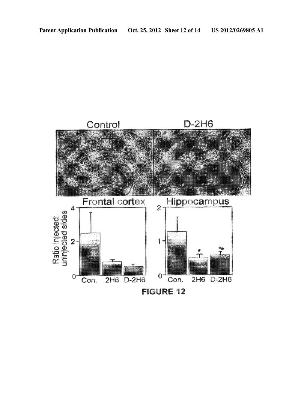 ANTIBODIES DIRECTED AGAINST AMYLOID-BETA PEPTIDE AND METHODS USING SAME - diagram, schematic, and image 13