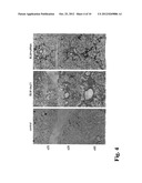 THERAPEUTIC AGENT FOR PULMONARY FIBROSIS diagram and image