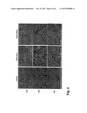 THERAPEUTIC AGENT FOR PULMONARY FIBROSIS diagram and image