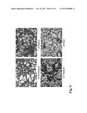 THERAPEUTIC AGENT FOR PULMONARY FIBROSIS diagram and image