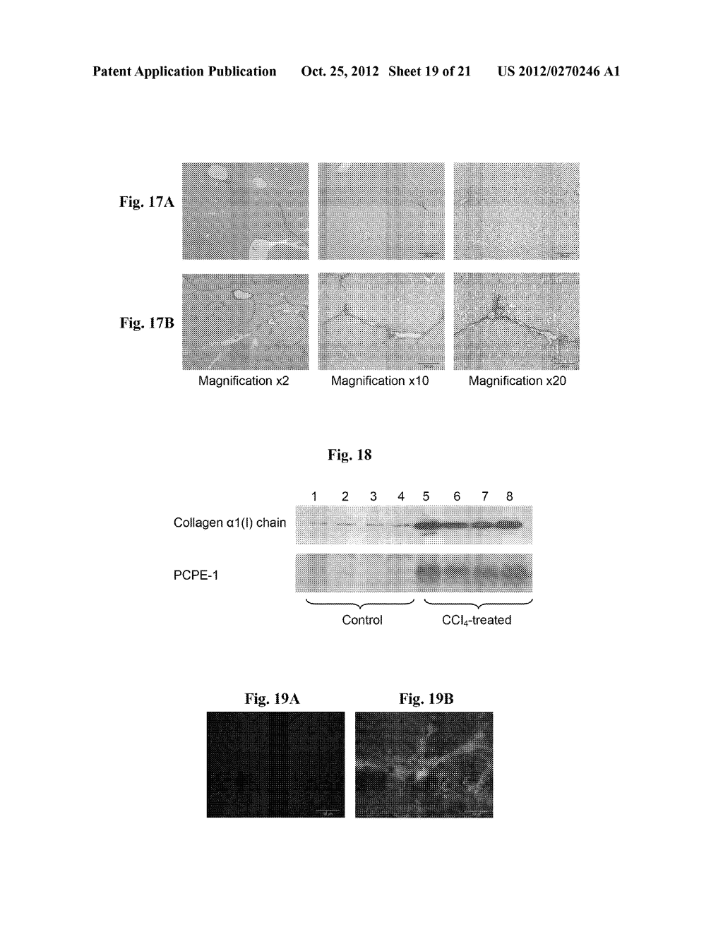 PROCOLLAGEN C-PROTEINASE ENHANCER (PCPE) BIOMARKER FOR BONE FORMATION - diagram, schematic, and image 20