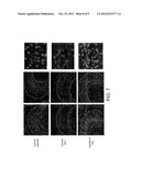 LACTOFERRIN AND GUT NEURONAL HEALTH IN ADULTS AND/OR ELDERLY diagram and image