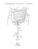 STEERABLE ENDOSCOPE AND IMPROVED METHOD OF INSERTION diagram and image