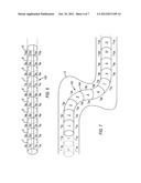 STEERABLE ENDOSCOPE AND IMPROVED METHOD OF INSERTION diagram and image