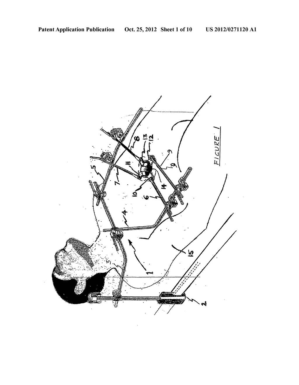 Retractor Blade and Assembly for Spinal Surgery - diagram, schematic, and image 02