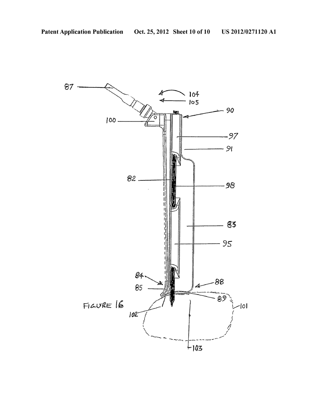 Retractor Blade and Assembly for Spinal Surgery - diagram, schematic, and image 11