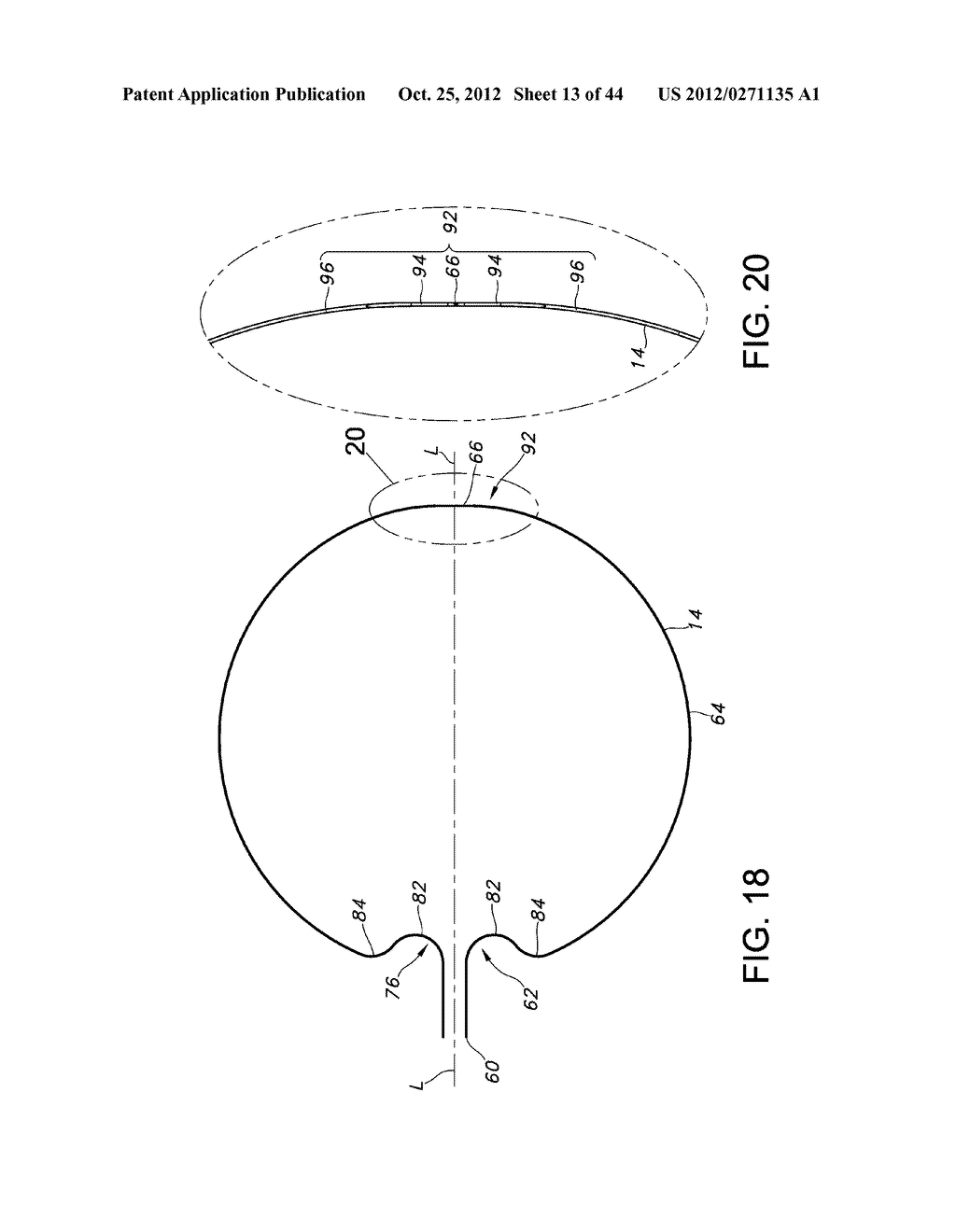 FLEXIBLE ELECTRODE ASSEMBLY FOR INSERTION INTO BODY LUMEN OR ORGAN - diagram, schematic, and image 14
