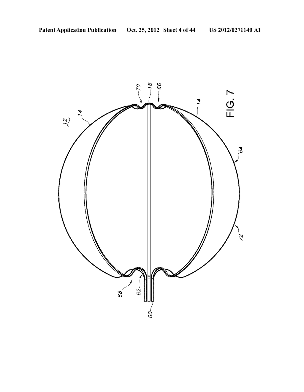 BASKET STYLE CARDIAC MAPPING CATHETER HAVING AN ATRAUMATIC BASKET TIP FOR     DETECTION OF CARDIAC RHYTHM DISORDERS - diagram, schematic, and image 05