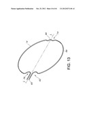 BASKET STYLE CARDIAC MAPPING CATHETER HAVING AN ATRAUMATIC BASKET TIP FOR     DETECTION OF CARDIAC RHYTHM DISORDERS diagram and image