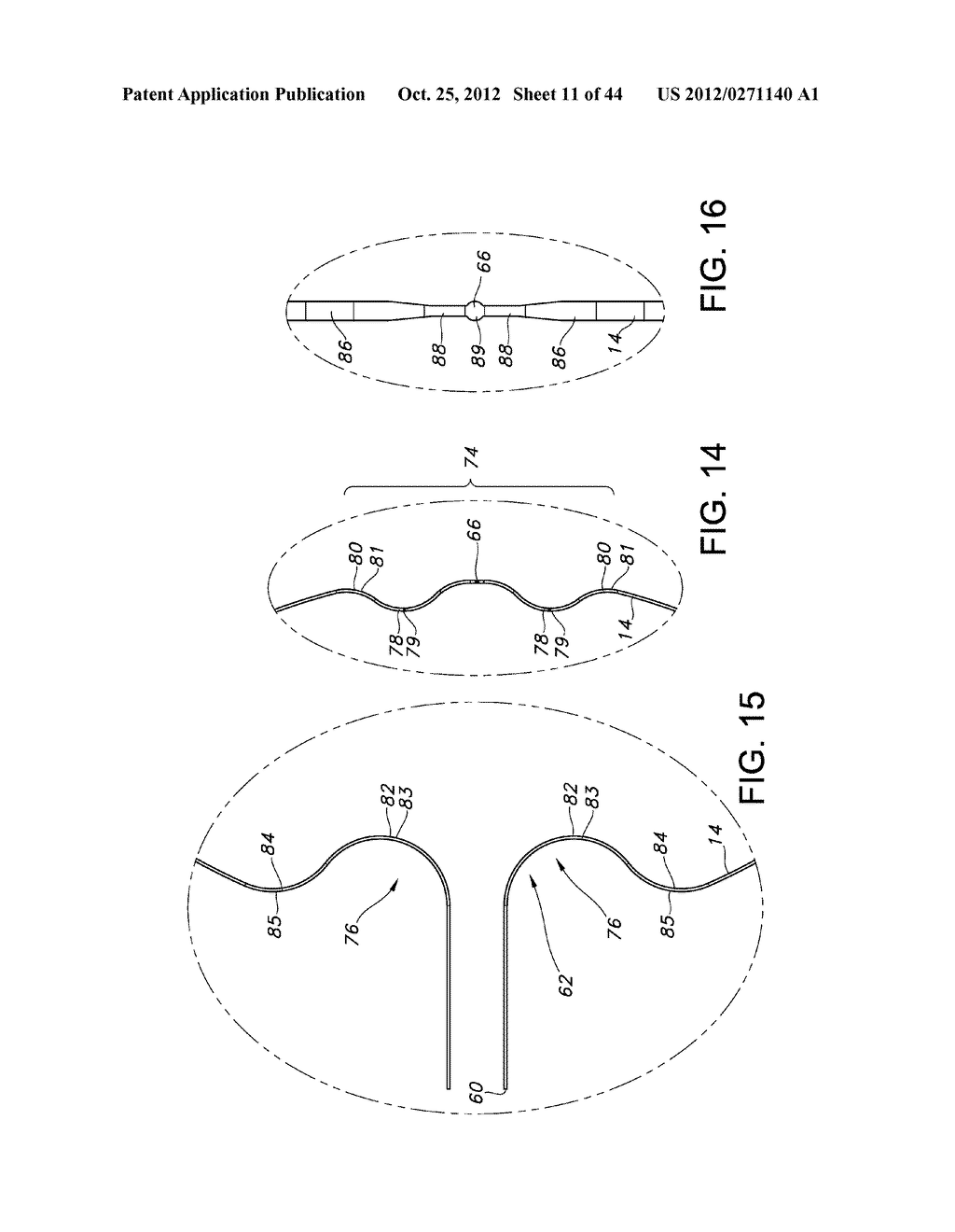 BASKET STYLE CARDIAC MAPPING CATHETER HAVING AN ATRAUMATIC BASKET TIP FOR     DETECTION OF CARDIAC RHYTHM DISORDERS - diagram, schematic, and image 12