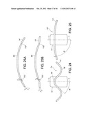 BASKET STYLE CARDIAC MAPPING CATHETER HAVING AN ATRAUMATIC BASKET TIP FOR     DETECTION OF CARDIAC RHYTHM DISORDERS diagram and image